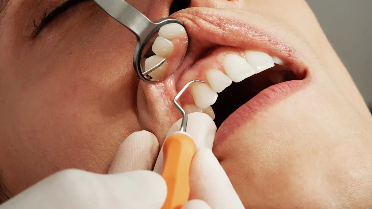 Dental Service Options for People With Dental Anxiety